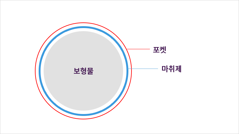 허쉬성형외과 맥스리프팅