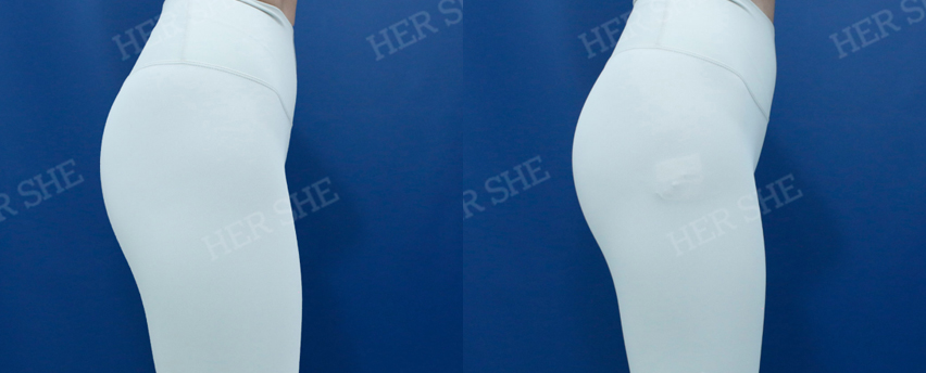 BEFORE & AFTER