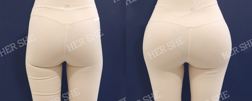 BEFORE & AFTER